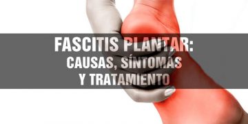 fascitis_plantar_causas_sintomas_tratamiento